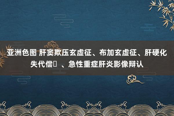亚洲色图 肝窦欺压玄虚征、布加玄虚征、肝硬化失代偿​、急性重症肝炎影像辩认